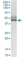 Anti-SGK196 Polyclonal Antibody Pair