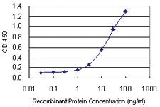 Anti-E2F3 Mouse Monoclonal Antibody [clone: 3C11]