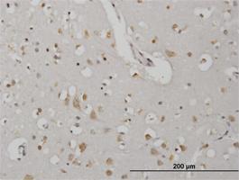 Anti-CDKL2 Mouse Monoclonal Antibody [clone: 1F6]