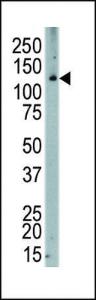 Anti-CSF1R Rabbit Polyclonal Antibody (FITC (Fluorescein))