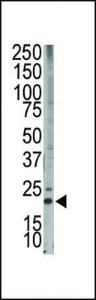 Anti-BCL2L11 Rabbit Polyclonal Antibody