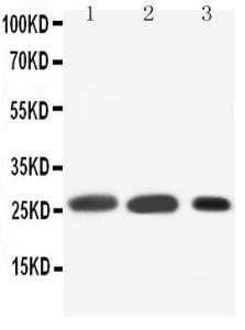 Anti-SFTPA1 Rabbit Polyclonal Antibody