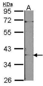 Anti-CDR2 Rabbit Polyclonal Antibody