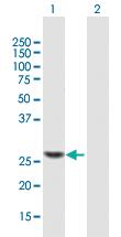 Anti-TRMU Mouse Polyclonal Antibody