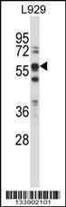 Anti-BIN1 Rabbit Polyclonal Antibody (AP (Alkaline Phosphatase))