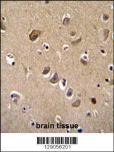 Anti-TTC9B Rabbit Polyclonal Antibody (FITC (Fluorescein Isothiocyanate))