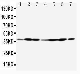 Anti-Annexin A2 Rabbit Polyclonal Antibody