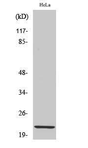 Western blot analysis of various cells using Anti-Claudin 1 Antibody