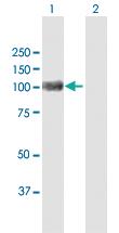 Anti-ACO1 Rabbit Polyclonal Antibody