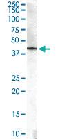 Anti-HSD3B1 Goat Polyclonal Antibody