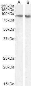 Anti-FBXO11 Antibody (A83058) (01 µg/ml) staining of nuclear HeLa (A) and A431 (B) cell lysate (35 µg protein in RIPA buffer) Detected by chemiluminescence