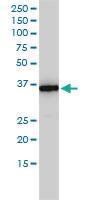 Anti-MTHFD2 Mouse Monoclonal Antibody [clone: 4G7-2G3]