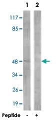 Anti-IKBKG Rabbit Polyclonal Antibody