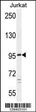 Anti-PTCHD4 Rabbit Polyclonal Antibody (Biotin)