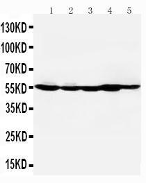 Anti-HDAC2 Rabbit Polyclonal Antibody