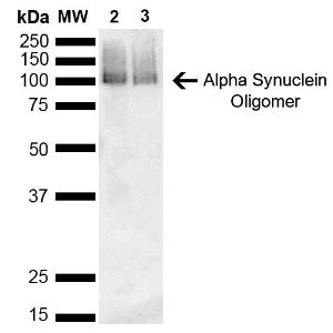 Western blot analysis of mouse, rat brain showing detection of 14 kDa Alpha Synuclein protein using Anti-alpha Synuclein Antibody [3C11] (A304959) at 1:1,000 for 2 hours at room temperatur