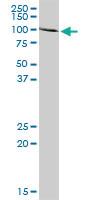 Anti-ACO1 Rabbit Polyclonal Antibody