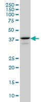 Anti-E2F4 Mouse Monoclonal Antibody [clone: 5B7]