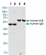 Anti-ALB Mouse Monoclonal Antibody [clone: 2H3D1,8F6F9]