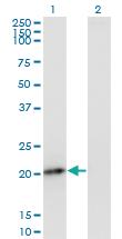 Anti-PMVK Mouse Monoclonal Antibody [clone: 2B8]