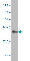 Anti-MAP2K5 Mouse Monoclonal Antibody [clone: 3E10]