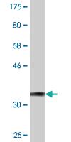 Anti-ADSSL1 Mouse Monoclonal Antibody [clone: 2D12]