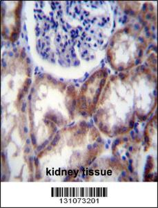 Anti-HYAL2 Rabbit Polyclonal Antibody (HRP (Horseradish Peroxidase))