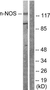 Anti-nNOS Rabbit Polyclonal Antibody