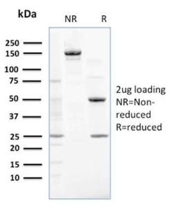 SDS-PAGE analysis of Anti-NME2 Antibody [CPTC-NME2-2] under non-reduced and reduced conditions; showing intact IgG and intact heavy and light chains, respectively. SDS-PAGE analysis confirms the integrity and purity of the antibody