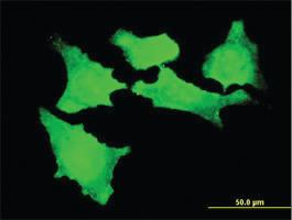 Anti-CDKL2 Mouse Monoclonal Antibody [clone: 1F6]