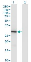 Anti-FAIM2 Mouse Monoclonal Antibody [clone: 2C2]