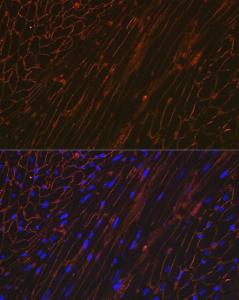 Anti-alpha Sarcoglycan Rabbit Monoclonal Antibody [clone: ARC2280]