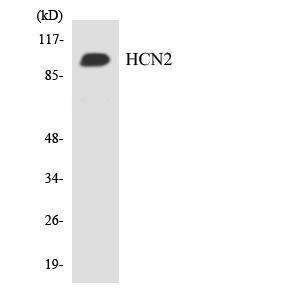 Western blot analysis of the lysates from HT 29 cells using Anti-HCN2 Antibody