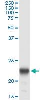 Anti-PMVK Mouse Monoclonal Antibody [clone: 2B8]