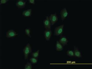 Anti-ARID1B Mouse Monoclonal Antibody [clone: 2F2]