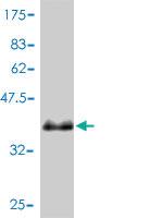 Anti-PSENEN Mouse Monoclonal Antibody [clone: 1C12-G5]