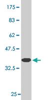 Anti-MFN2 Mouse Monoclonal Antibody [clone: 6A2]