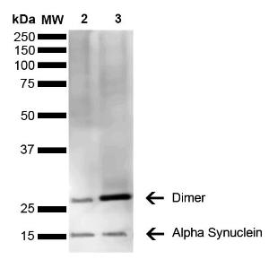 Western blot analysis of human brain showing detection of 14 kDa Alpha Synuclein protein using Anti-alpha Synuclein Antibody [3C11] (A304959) at 1:1,000 for 2 hours at room temperatur