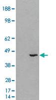 Anti-HSD3B1 Goat Polyclonal Antibody