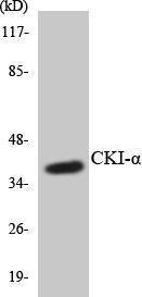 Western blot analysis of the lysates from HT 29 cells using Anti-CKI-alpha Antibody