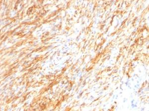 Anti-GFAP Mouse Monoclonal Antibody [clone: GA-5 + ASTRO/789]