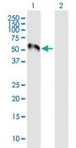 Anti-MEF2C Mouse Polyclonal Antibody