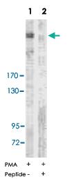 Anti-ACACA Rabbit Polyclonal Antibody