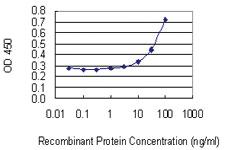 Anti-PMVK Mouse Monoclonal Antibody [clone: 2B8]