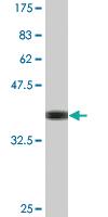 Anti-MFN2 Mouse Monoclonal Antibody [clone: 4H8]