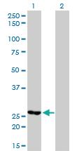 Anti-MTHFD2 Mouse Monoclonal Antibody [clone: 4G7-2G3]