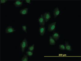 Anti-ARID1B Mouse Monoclonal Antibody [clone: 2F2]