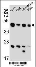 Anti-BIN2 Rabbit Polyclonal Antibody (APC (Allophycocyanin))