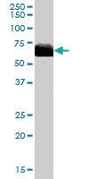 Anti-CYP17A1 Goat Polyclonal Antibody