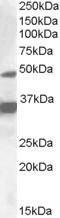 Anti-NR1I2 Antibody (A83061) (1 µg/ml) staining of HepG2 lysate (35 µg protein in RIPA buffer). Detected by chemiluminescence